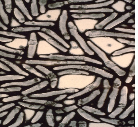 Microscopic view of bacteria